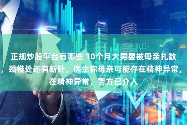 正规炒股平台有哪些 10个月大男婴被母亲扎数百针后就医，颈椎处还有断针，医生称母亲可能存在精神异常，警方已介入